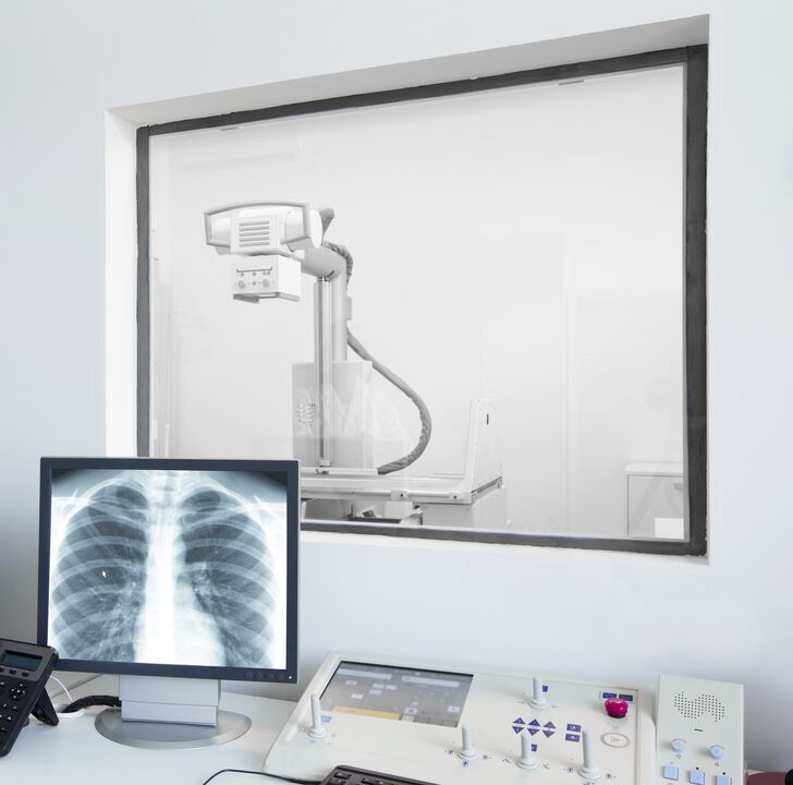 Omurga röntgeni - osteokondroz teşhisi için ana yöntem