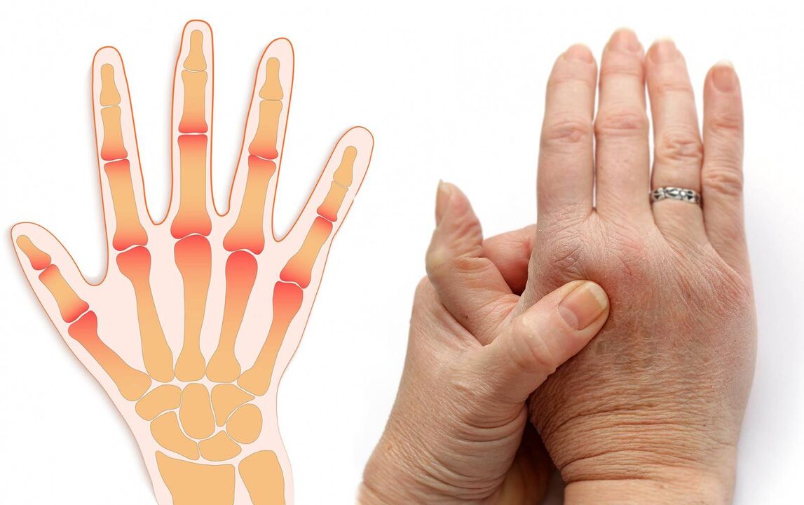 parmak hastalıkları